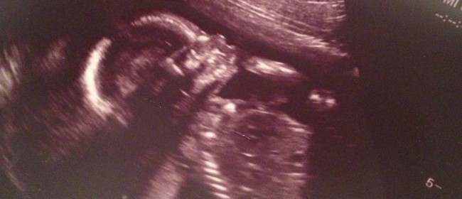 baby perez 1 (1)