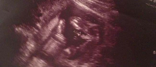 baby perez 2 (2)